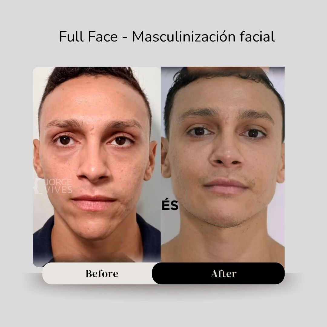 CASOS DR JORGE VIVES