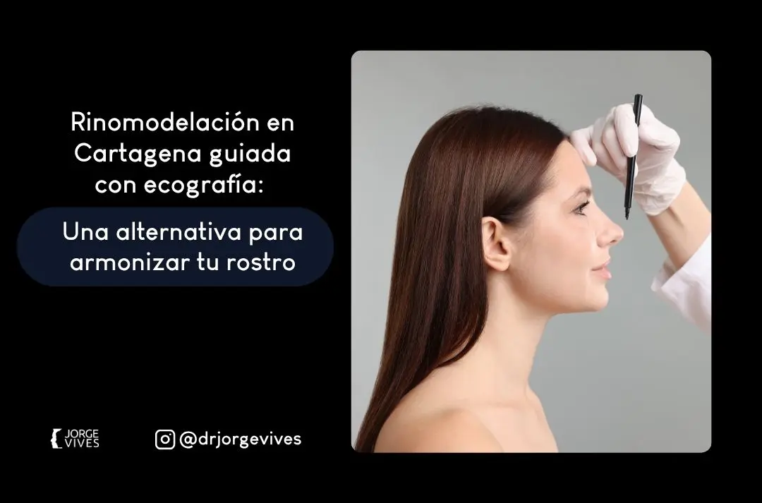 Rinomodelación en Cartagena guiada con ecografía Una alternativa para armonizar tu rostro - Jorge Vives