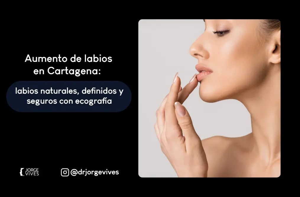 Aumento de labios en Cartagena- Dr. Jorge Vives- Acido Hialuronico