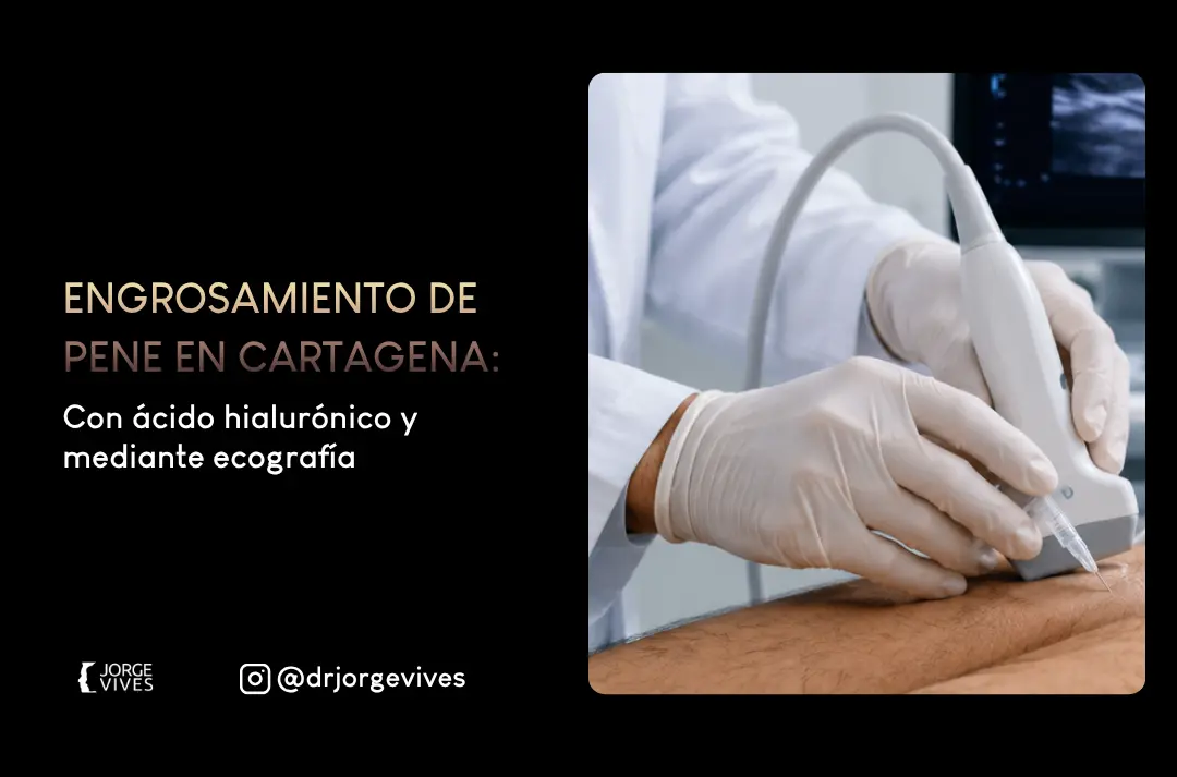 Engrosamiento de pene en cartagena - Dr Jorge Vives