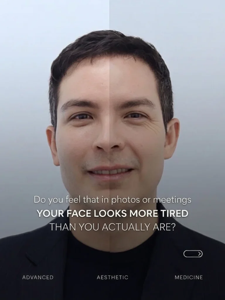 Does your face look more tired than you actually are? Advanced aesthetic medicine