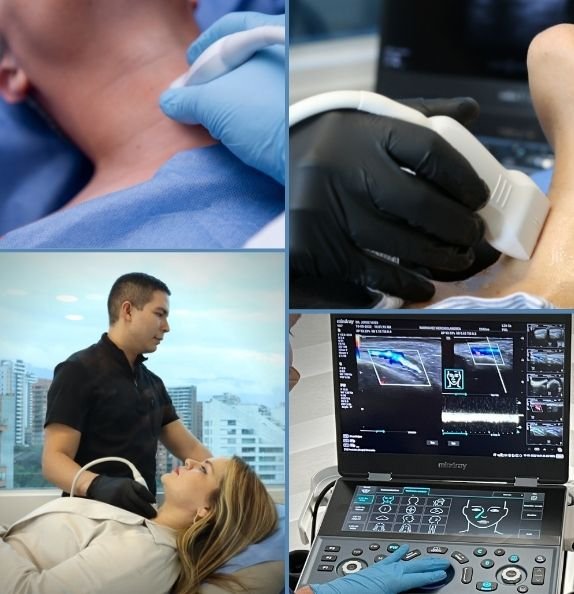 El Dr. Jorge Vives realiza una ecografia de tiroides: transductor sobre el cuello, estudio Doppler y su equipo Mindray