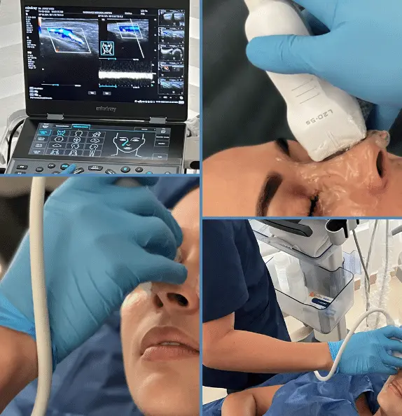 Ecografia dermatologica facial con transductor de muy alta frecuencia y el estudio en el equipo Mindray